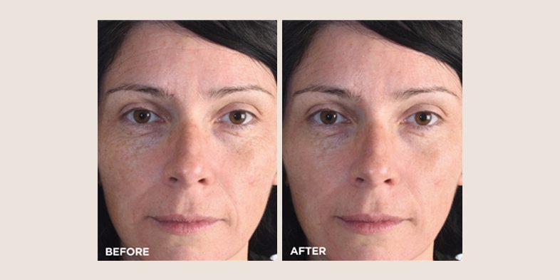 In Article How To Use Niacinamide And Retinol Moisturizer